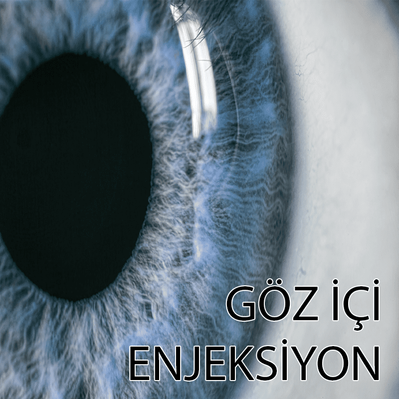 göz içi enjeksiyon